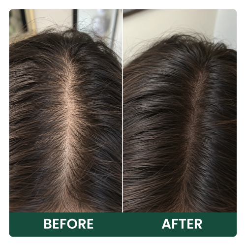 hair improvement