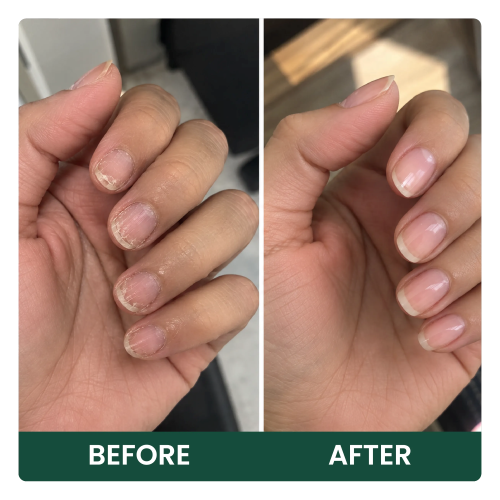 nails imporvement